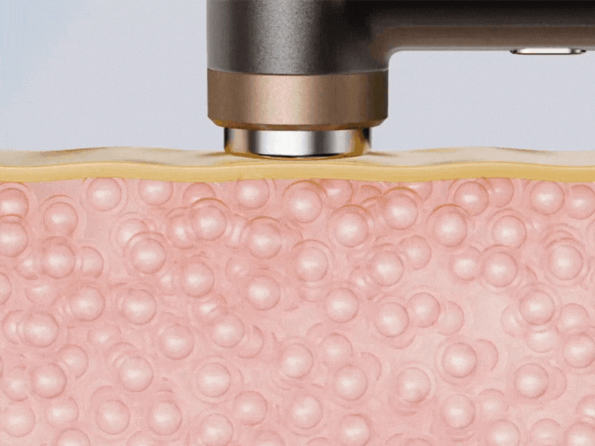 셀비젼 쎄라쥬 뷰티 디바이스 세트 (리프팅,경락,고주파, 초음파)