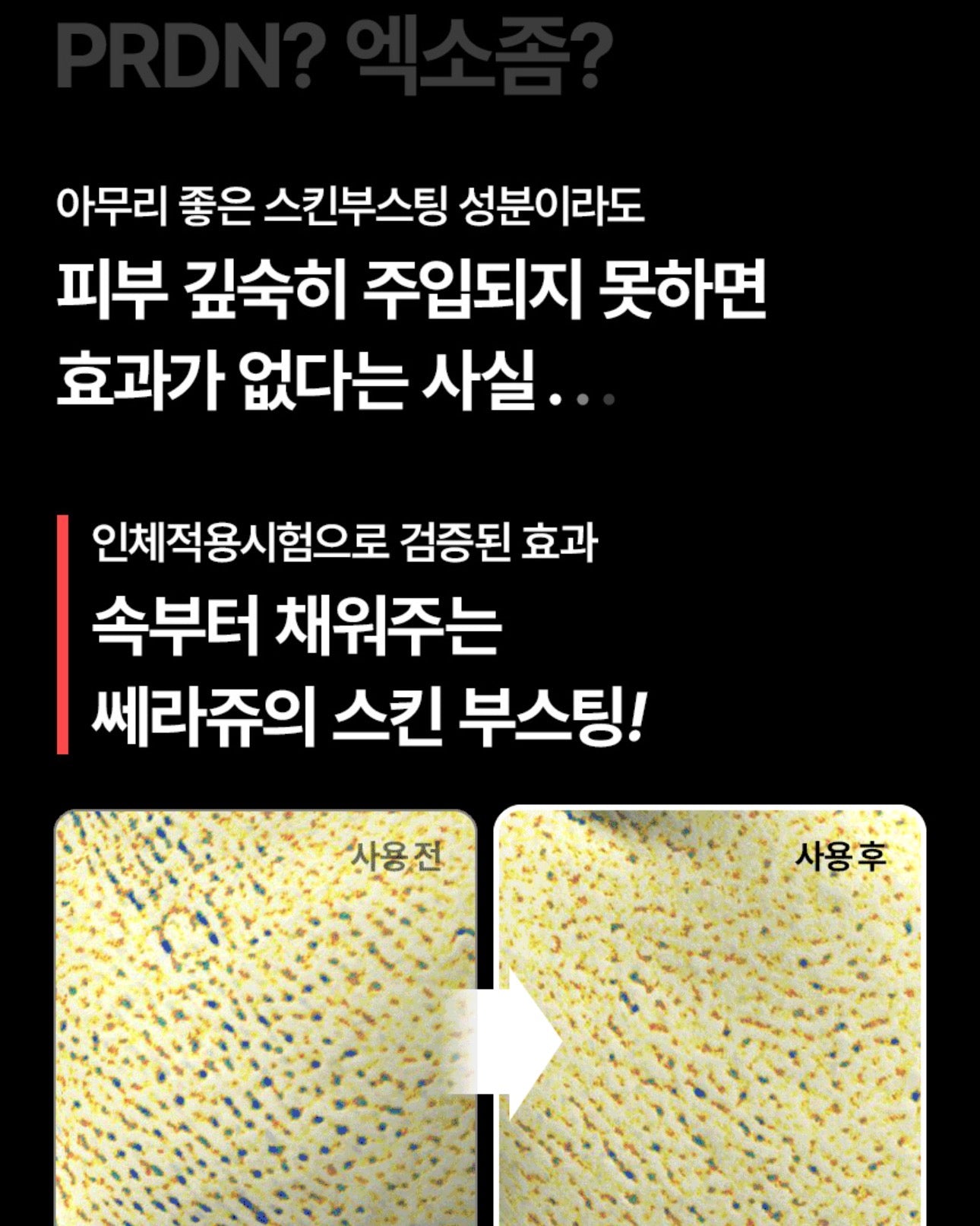 셀비젼 쎄라쥬 뷰티 디바이스 세트 (리프팅,경락,고주파, 초음파)