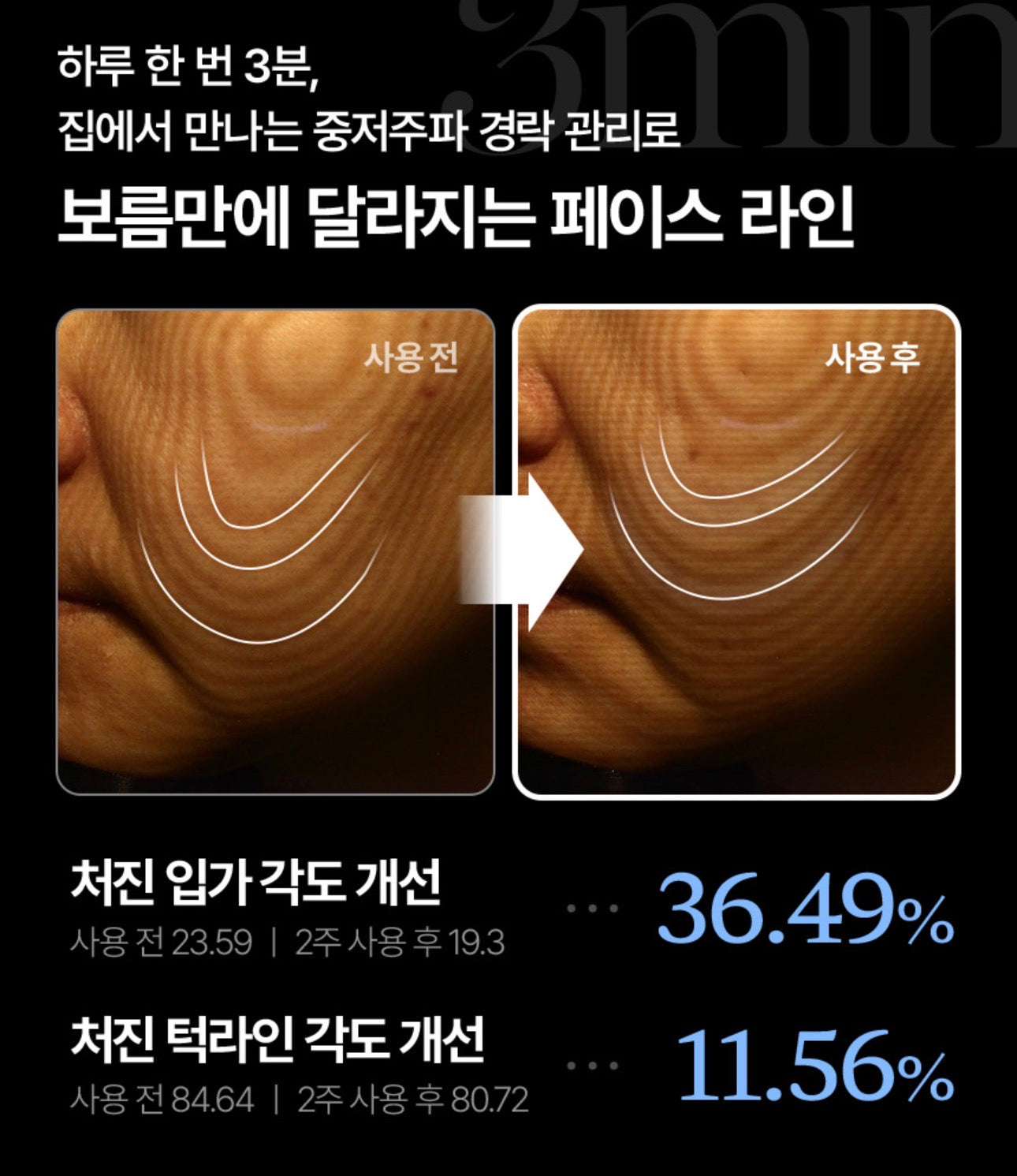 셀비젼 쎄라쥬 뷰티 디바이스 세트 (리프팅,경락,고주파, 초음파)