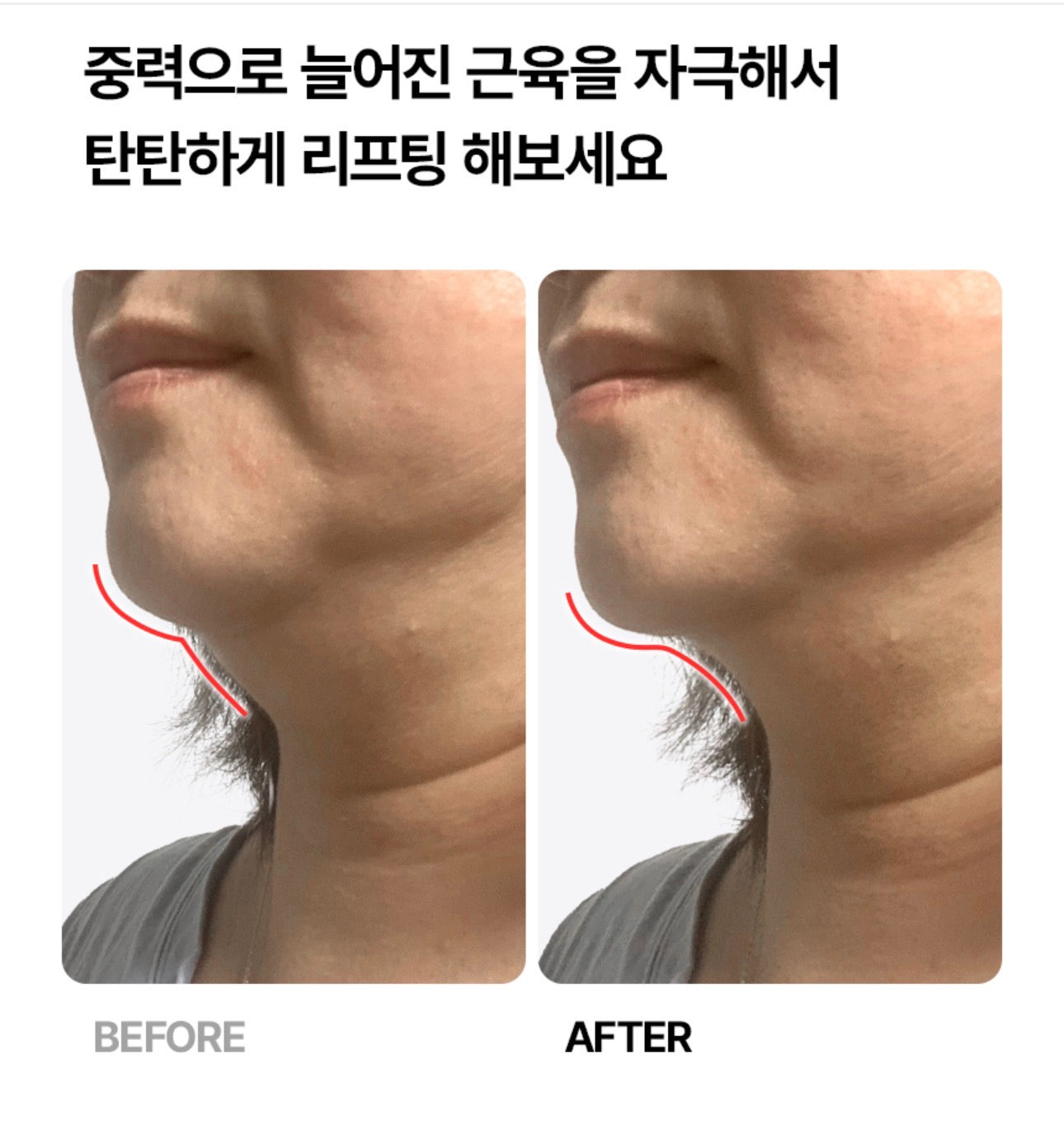 셀비젼 쎄라쥬 뷰티 디바이스 세트 (리프팅,경락,고주파, 초음파)