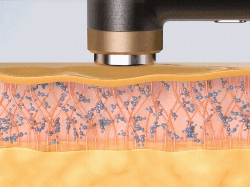 셀비젼 쎄라쥬 뷰티 디바이스 세트 (리프팅,경락,고주파, 초음파)