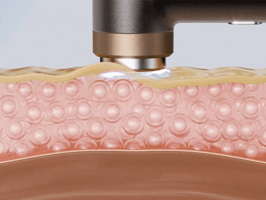 셀비젼 쎄라쥬 뷰티 디바이스 세트 (리프팅,경락,고주파, 초음파)