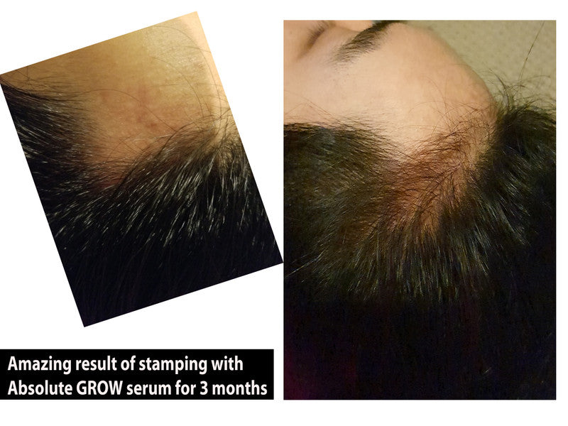 Absolute GHK-cu Stem Cells & Peptide Hair Growth Serum and Shampoo MTS Set