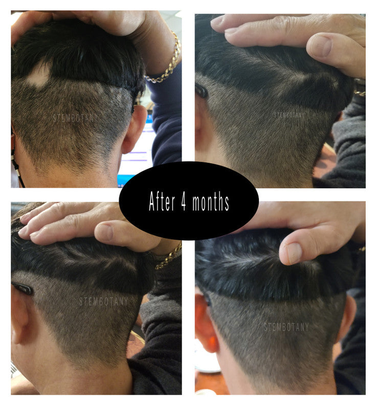 Absolute Hair Growth Shampoo and Conditioner Set with Hair Growth Serum