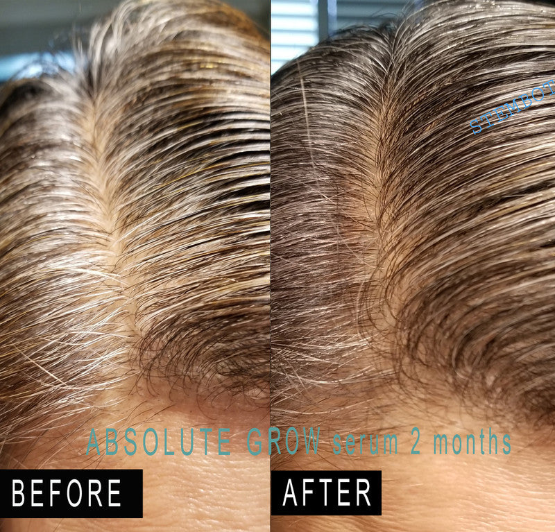 Absolute Hair Growth Shampoo and Conditioner Set with Hair Growth Serum