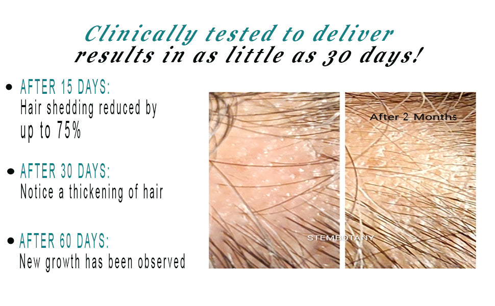 Absolute GHK-cu Stem Cells & Peptide Hair Growth Serum and Shampoo MTS Set