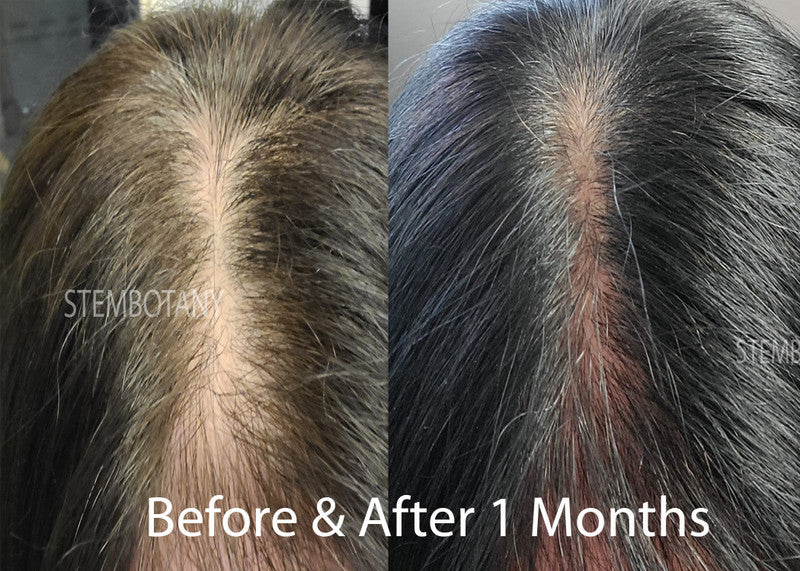 Absolute GHK-cu Stem Cells & Peptide Hair Growth Serum and Shampoo MTS Set