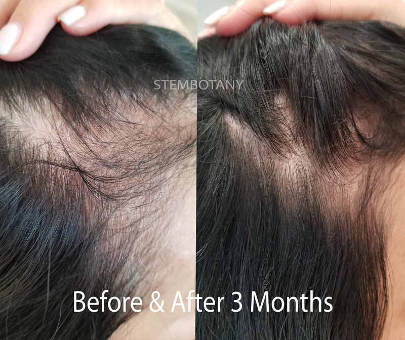 Absolute GHK-cu Stem Cells & Peptide Hair Growth Serum and Shampoo MTS Set