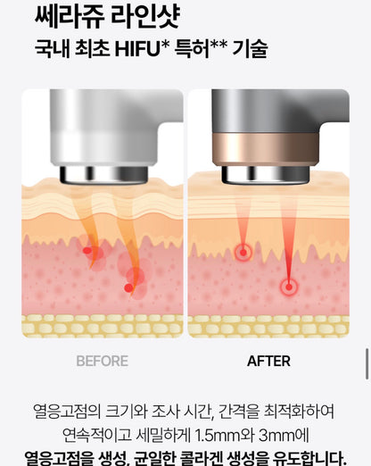 [블프 최저가 공구] 셀비젼 쎄라쥬 뷰티 디바이스 세트