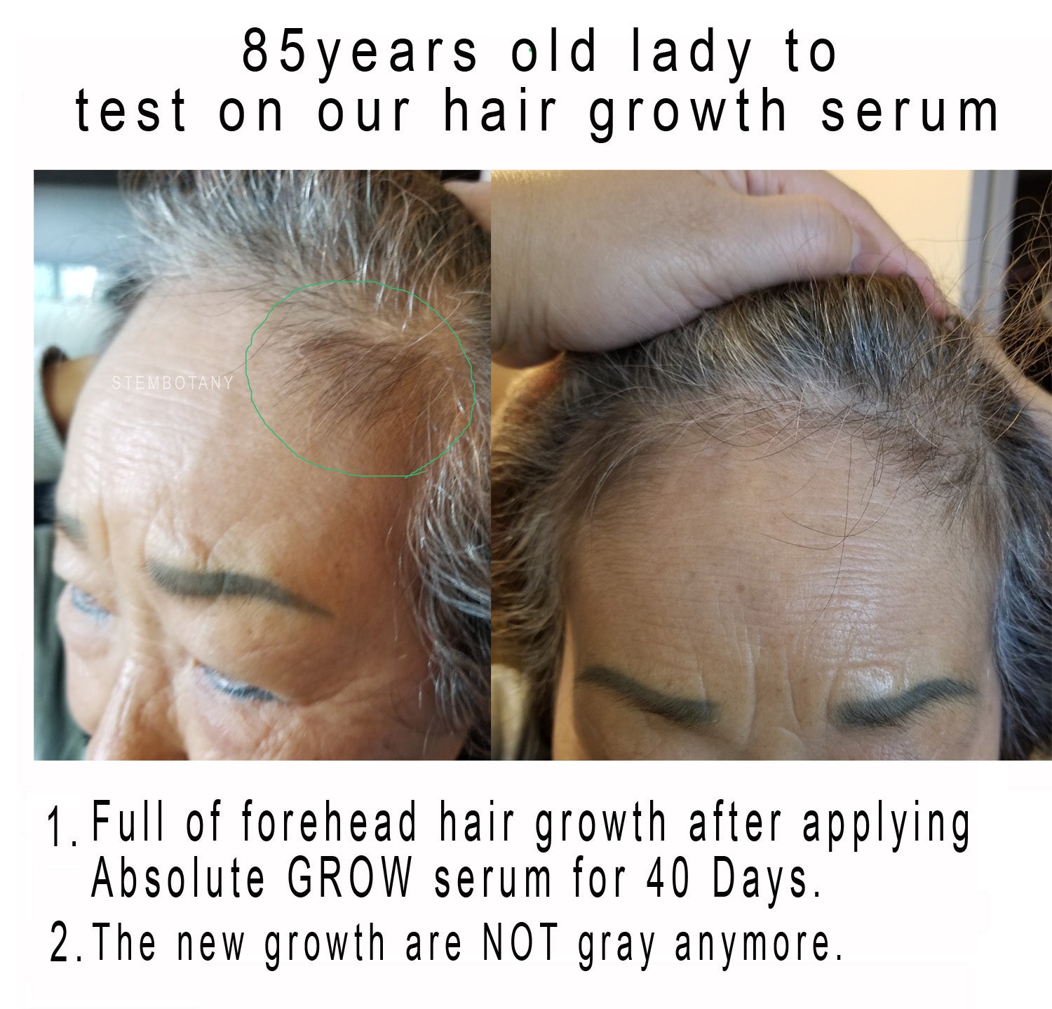 Absolute GHK-cu Stem Cells & Peptide Hair Growth Serum and Shampoo MTS Mall of California Absolute GHK-cu Stem Cells & Peptide Hair Growth Serum and Shampoo MTS Mall of California