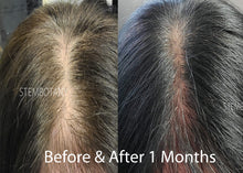 Load image into Gallery viewer, Absolute GHK-cu Stem Cells &amp; Peptide Hair Growth Serum and Shampoo MTS Set
